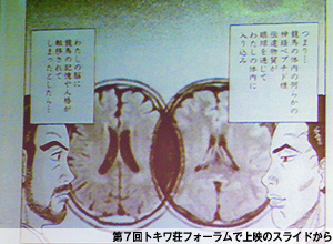 『仁‐JIN‐』（20巻）から、龍馬と仁の脳のMRI画像