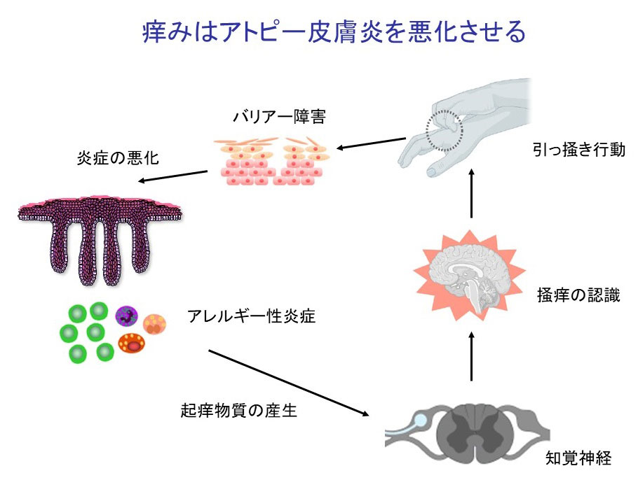 痒くなって搔くほど進行するアトピー性皮膚炎の仕組み。（佐賀大学プレスリリース資料を抜粋）