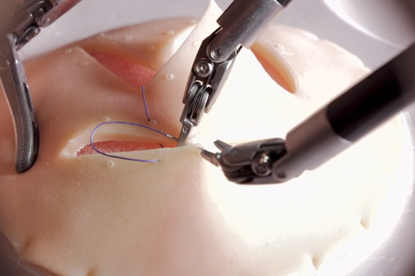 ロボット鉗子の手術のイメージ