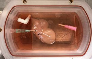 【九州大学】iPS細胞由来の人工肝臓作成に成功〈世界初〉　九州大病院の武石助教ら