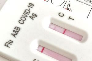 ミズホメディー、25年12月期の業績予想を大幅上方修正　インフルエンザ流行が背景