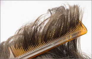 東洋新薬、松樹皮素材による育毛作用を確認